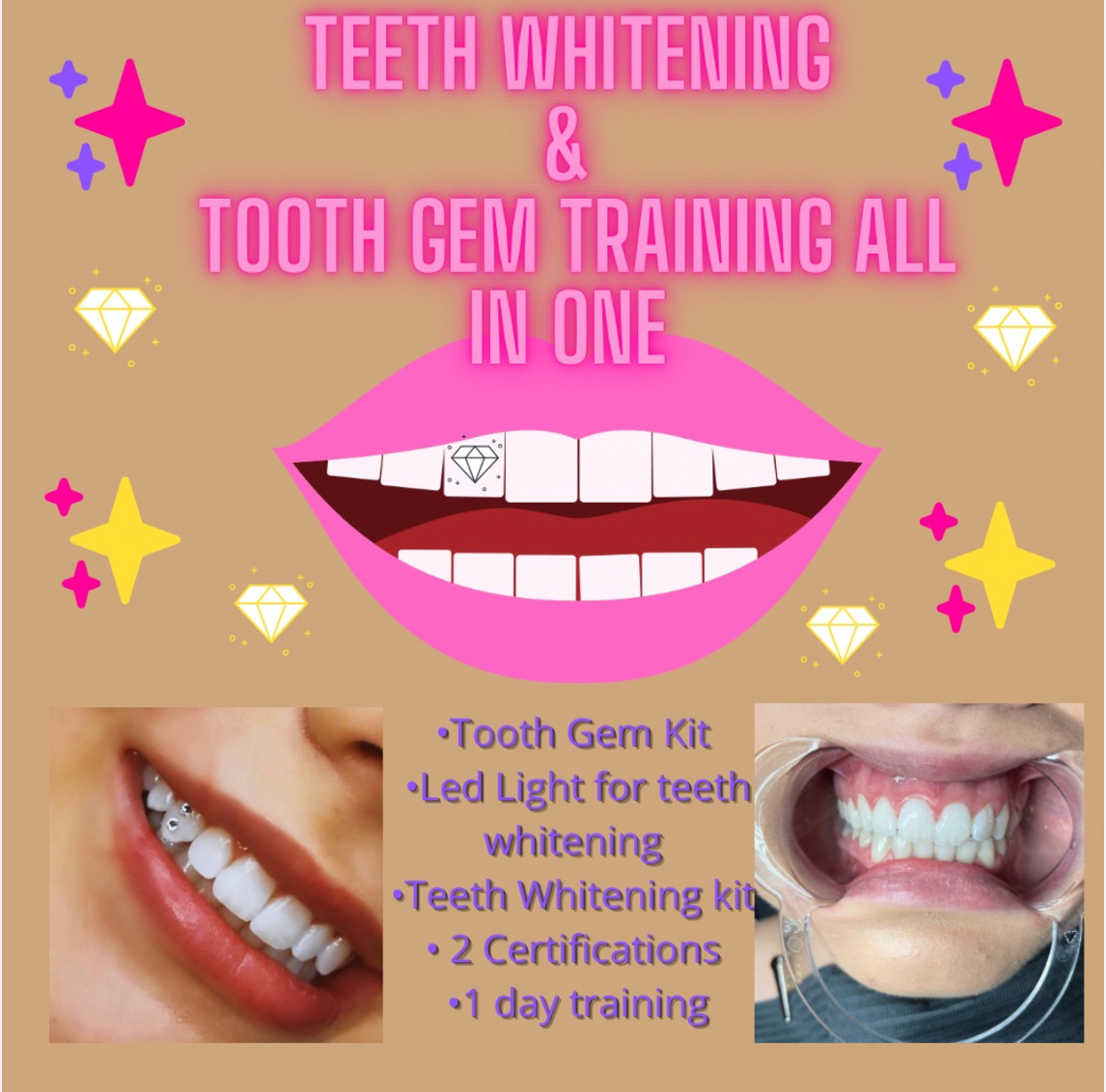 Teeth Whitening/Tooth Gem Training – Olympus Beauty Studios