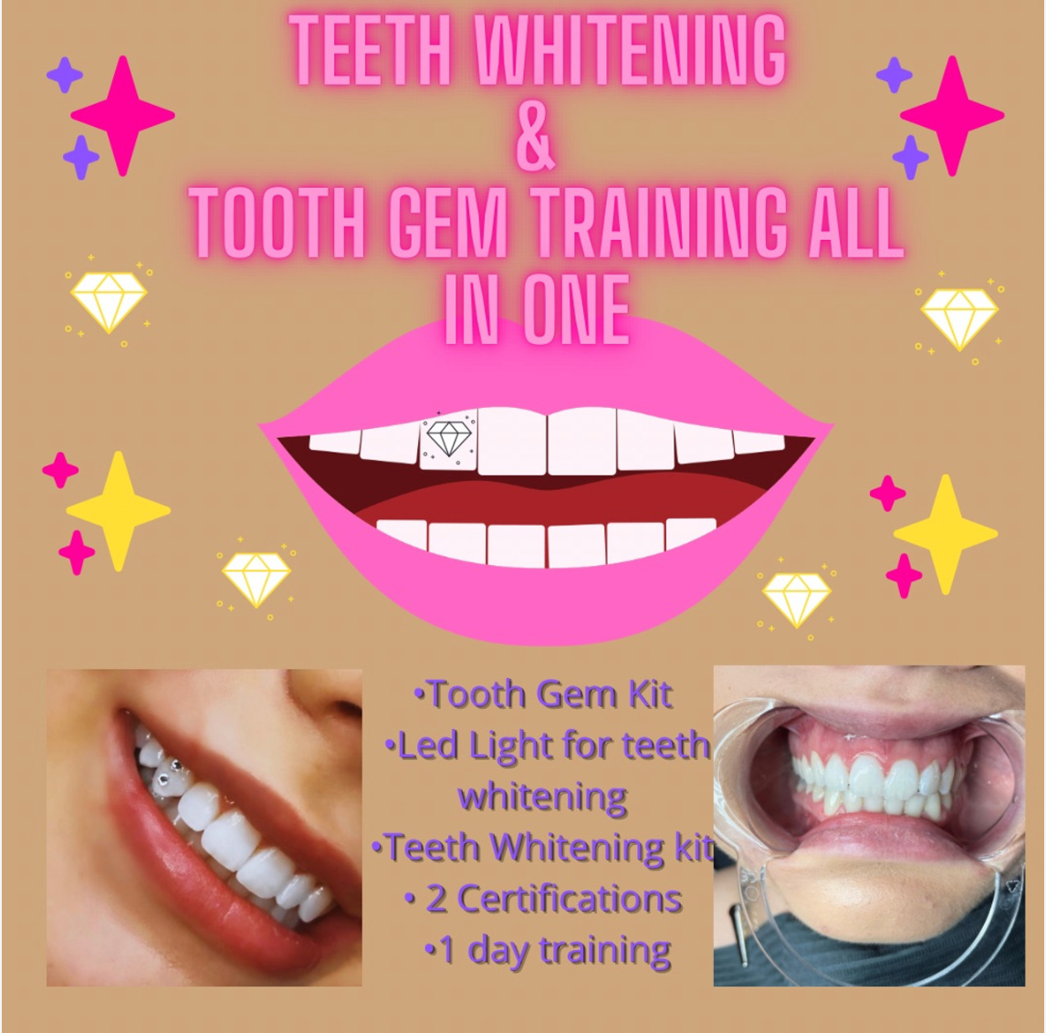 Teeth Whitening/Tooth Gem Training